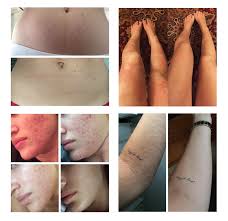 Coffee, salt and sugar scrubs like to find their way to your hair. Coffee Scrub Results Before And After Facial Scrub