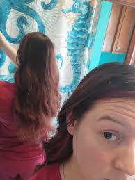 Any suggestions for hair loss specialists?