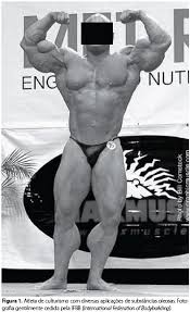 The former soldier became an internet sensation after sharing pictures of his cartoonish arms. Scielo Brasil Doping Cosmetico A Problematica Das Aplicacoes Intramusculares De Oleos Doping Cosmetico A Problematica Das Aplicacoes Intramusculares De Oleos