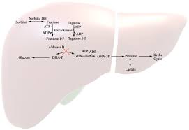 Image result for Hereditary Fructose Intolerance