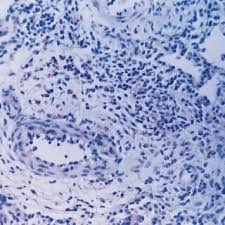 Lawrence R. Shoemaker's research works