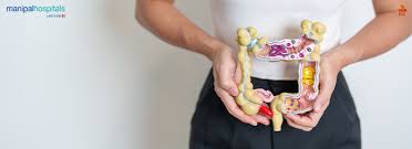 Image result for Diverticulitis