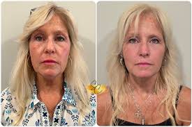 Shaun Charles Med Spa