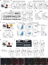Learn more about myocarditis or inflammation of heart muscles, possible causes, symptoms, treatment, personal experiences. Jci Insight Antiinflammatory Activity Of Angptl4 Facilitates Macrophage Polarization To Induce Cardiac Repair