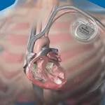  Heart alert: Pacemakers can be hacked, new research shows