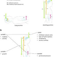 Pdf Gravitational Shunt Valves In Hydrocephalus To Challenge The Sequelae Of Over Drainage