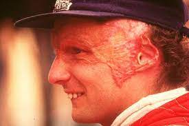5 live daily looks back at the horrific accident at the nurburgring grand prix. Niki Lauda Crash How F1 Great Raced Just 40 Days After Nearly Dying In Raging Inferno Mirror Online