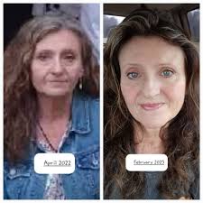 Another Doctor to beware of. Dr. Elliot Hirsch. I'm stunned, absolutely  stunned and now crying. The surgeon who placed the toxic implant in me  after a mastectomy is