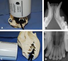 Dental Radiology Series Techniques For Intraoral Radiology