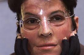 The day I became the woman in the mask