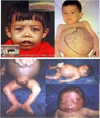 Paediatric Dentistry Laman 4 Den To Sca Notes
