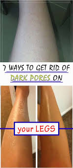 7 Ways To Get Rid Of Dark Pores On Your Legs Homemade Beauty Ingrown Hair Ingrown Hair Remedies Shaving Legs