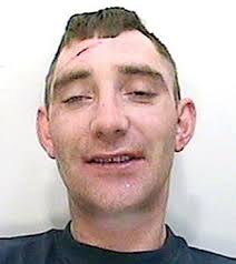 Bentham man jailed for biting off neighbour's nose