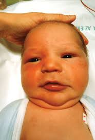 Image result for Harlequin Color Change