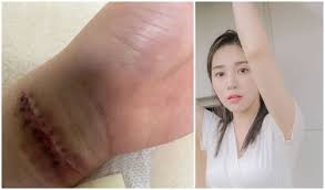 If u don't have it, draw it and have it! Update Aoa S Mina Cut Hand Commits Suicide Remember Sulli She Haunted Unable To Forgive Jimin Lovekpop95