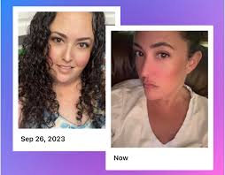 Pain is unbearable but getting better slowly