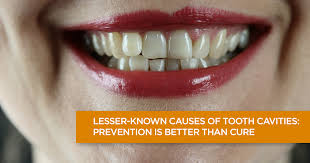How to reverse tooth decay in dogs. Tooth Cavity Symptoms Causes And Treatment Apollo Hospitals Blog