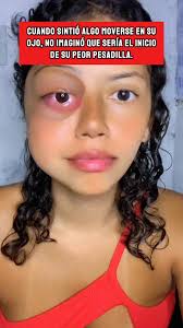 Descubrimiento aterrador en el ojo de una joven