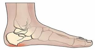 Pin On Home Remedies