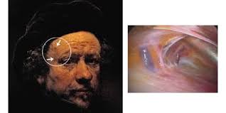 Oculoplastic Surgery