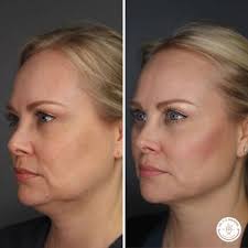 DR. J. J. WENDEL PLASTIC SURGERY