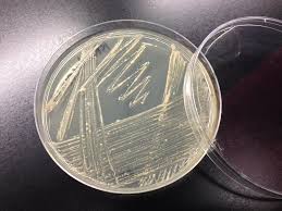 Image result for Rhodococcus equi