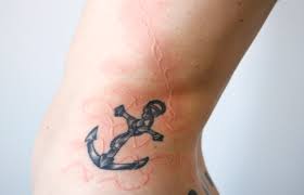 If you're having an allergic reaction to your tattoo, you might get a rash that's usually lumpy, bumpy and raised tattoos are all common during (and sometimes slightly after) the tattoo healing process. Personal Adornment Can People With Dermatographia Get Tattoos Skintome