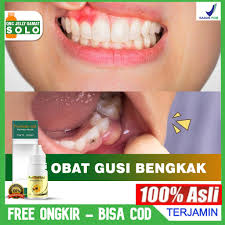 We did not find results for: Obat Gusi Bengkak Gigi Sakit Gigi Ngilu Gusi Berdarah Herbal Alami Propolis Sm Original Asli Shopee Indonesia