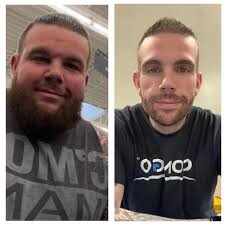 Being comfortable in own skin after weight loss