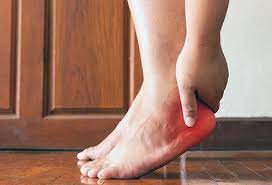 Heel Spurs: Treatment, Causes, Symptoms & Pictures