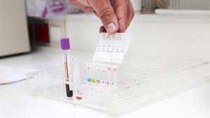 Dieta pentru grupa de sange ab: Grupa De Sange B3 Cum IÅ£i InfluenÅ£eazÄƒ SÄƒnÄƒtatea Si Personalitatea