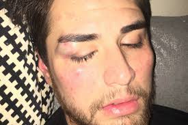 Fundraiser by Kaia Hill : Ekela's Healing & Medical Expenses