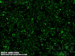 Image result for ANA Staining Pattern