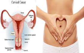 Bleeding or pain may occur between menstrual periods, after sexual intercourse, or in postmenopausal women. 7 Alarming Symptoms Of Cervical Cancer You Should Be Aware Of Inminutes Magazine