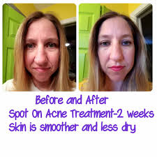 What can I use for my skin?