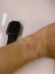 We did not find results for: Red Spot Under The Clock Sensor Apple Community