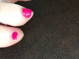 Check spelling or type a new query. Polish On My Skin And Again Rough Dry Skin And Cuticles She Didn T Work On At All Picture Of The Wild Orange Spa Abbotsford Tripadvisor