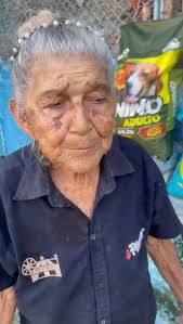 El viernes nos etiquetaron pidiendo ayuda para este angelito en la tierra  que cuida de la creación de Dios. , Ayer hicimos la entrega de 4 bolsas de  comida, pero lo que realmente urge es hacer una ...