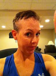 Hair loss due to radiation therapy can be temporary or permanent 1. Pin On Brain Tumor Awareness