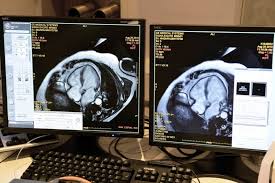 Structural Abnormality On Cmr May Predict Adverse Cardiac Events The Cardiology Advisor