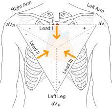 Just like a a battery that have positive an begative poles. Bipolar Leads Ecg Lead Placement Normal Function Of The Heart Cardiology Teaching Package Practice Learning Division Of Nursing The University Of Nottingham