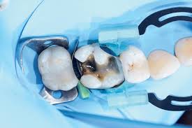 Image result for Multidentia