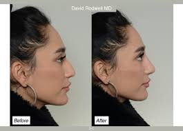Charleston Facial Plastic Surgery