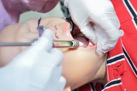 Baik itu obat gigi alami ataupun obat gigi yang dibeli di. Cabut Gigi Harus Punya Alasan Tepat Alodokter