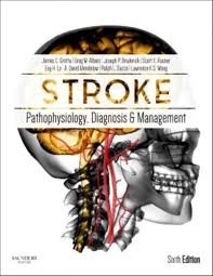 Image result for Stroke Pathophysiology
