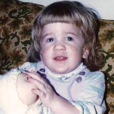 Learn More About Mps Vi Maroteaux Lamy Syndrome Mps Reference