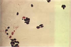 Image result for Tragia glabrata