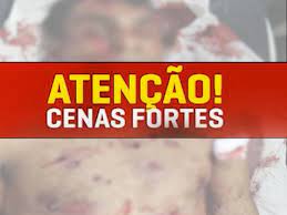 .lazaro introdução compreendendo que o entendimento do corpo e todos os fenômenos cruamente. Qehxppsmstvvvm