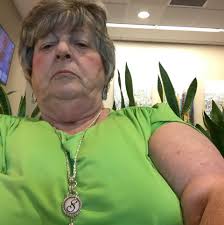 Fibromyalgia causing denture and clothing discomfort