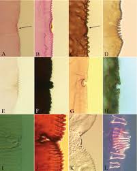 Image result for Embelia welwitschii